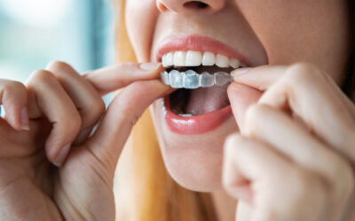 Can You Smoke With Invisalign?