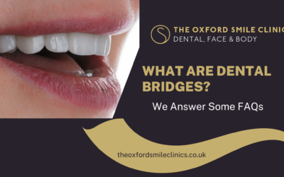 What Are Dental Bridges? We Answer Some FAQs