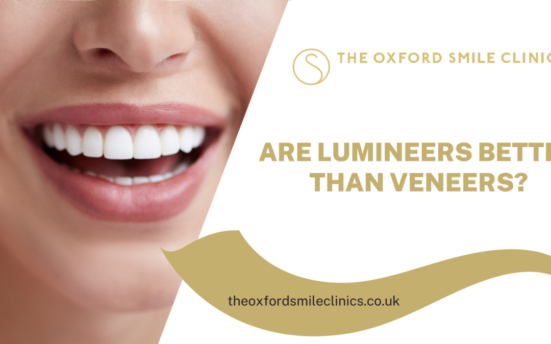 Are Lumineers Better Than Veneers?