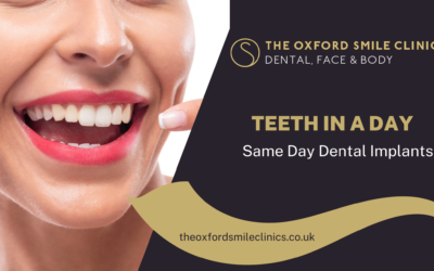 Teeth In A Day: Same Day Dental Implants